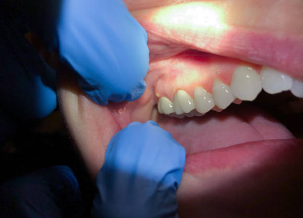 Best Dentist for Dental Trauma  in Brownstown, IN