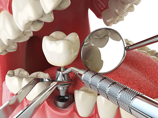 Best Urgent Tooth Repair  in Brownstown, IN